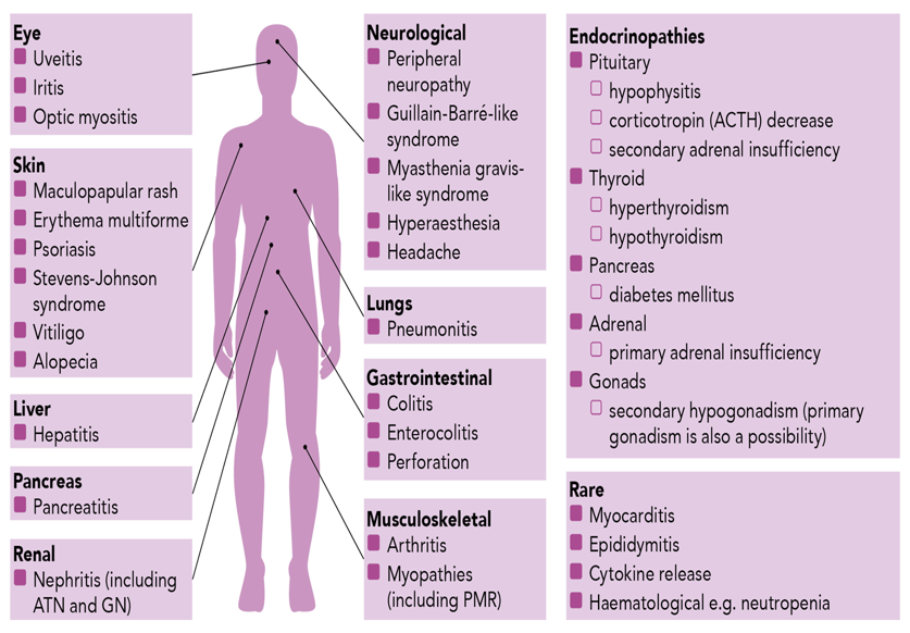 Diagram of the body showing which side effects might affect different parts of the body. The side effects are listed in the main text of the web page
