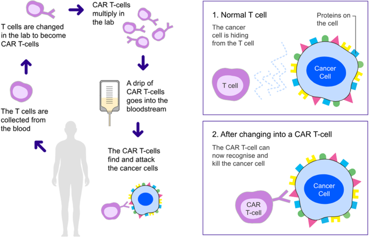 A diagram shows the process in which T cells are collected from the blood, changed in the lab to become CAR T-cells, which then multiply before they are put back into the bloodstream using a drip, so they can find and attack cancer cells. A second image shows the difference between a normal T cell, which cancer cells can hide from, and CAR T-cells that can recognise and kill cancer cells.