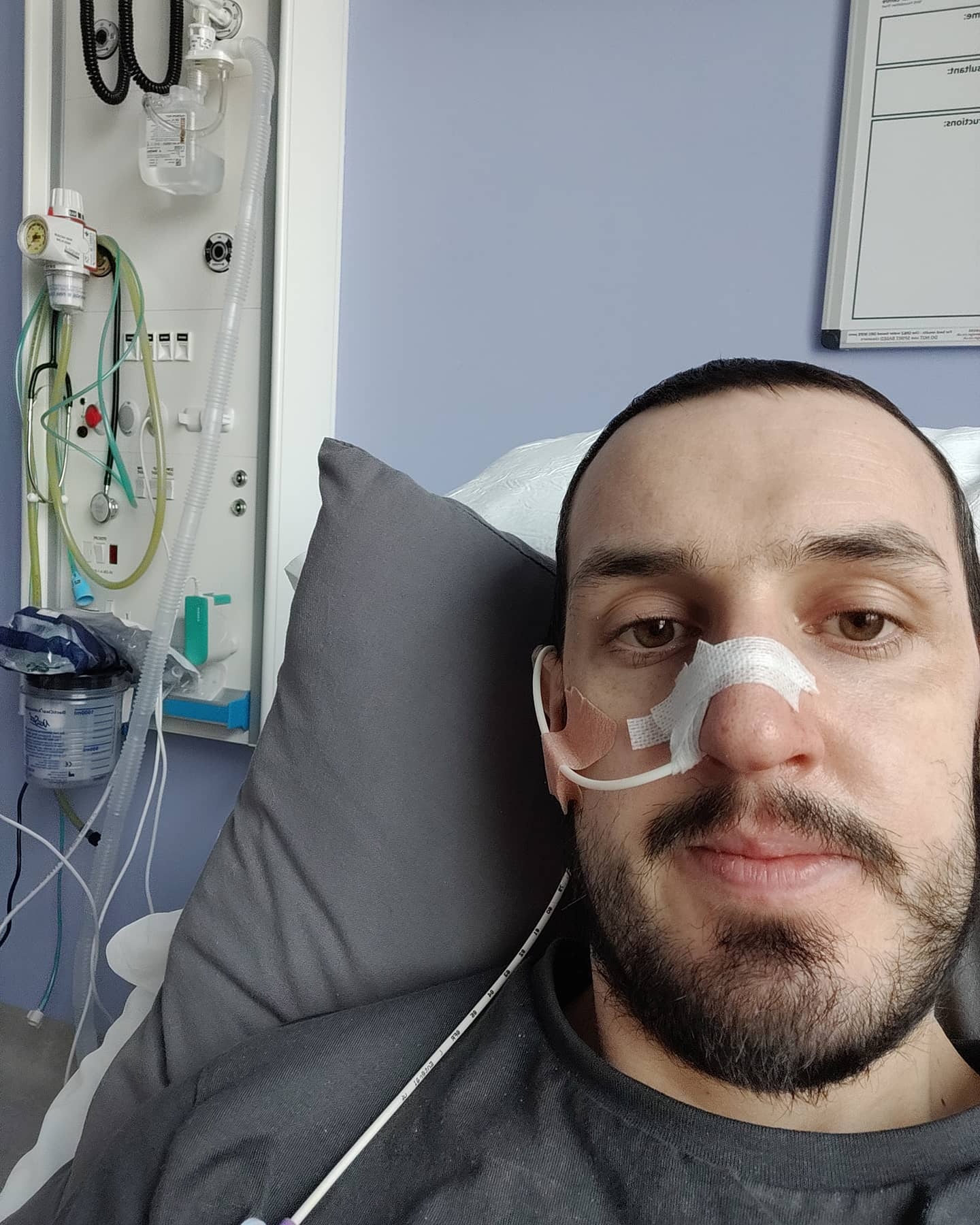 Adam during treatment