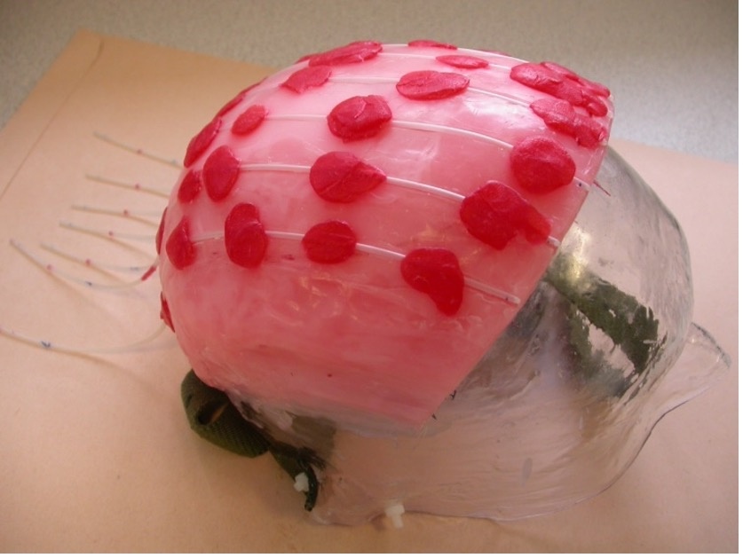 Figure 3: Example of a scalp mould