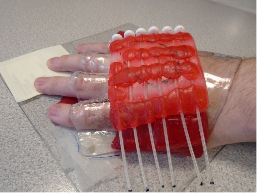 Figure 2: Example of a hand mould